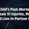 Kerala Horror: Toddler Found With 51 Injury Marks, Mother and Live-In Partner Arrested for Murder 
