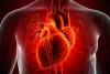 Cardiovascular diseases behind 1 in 3 global deaths in 2023: Study