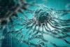 Global Experts Set New Priorities for Cholangiocarcinoma Management in 2026