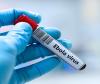 India Confirms Zero Ebola Cases While Expanding Global Aid Response; Health Ministry Issues Strict 21-Day Travel Advisory