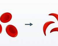 India launches 1st indigenous CRISPR-based gene therapy for Sickle Cell Disease