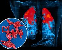 IIT Bombay study shows how TB bacteria shield themselves from antibiotics, stay alive longer