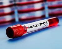 2,501 new confirmed mpox cases, 12 deaths reported from 44 countries in October: WHO