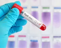 Health Authorities Escalate Vigilance Following Nipah Virus Concerns in West Bengal