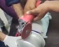 Surgical Precision Saves Toddler After Freak Accident with Kitchen Utensil