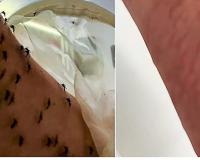 Entomologist Sustains Laboratory Mosquito Populations Through Personal Blood Feeding