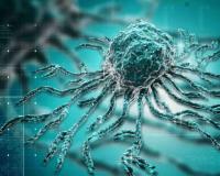 Global Experts Set New Priorities for Cholangiocarcinoma Management in 2026