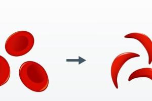 India launches 1st indigenous CRISPR-based gene therapy for Sickle Cell Disease