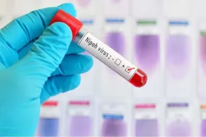 Health Authorities Escalate Vigilance Following Nipah Virus Concerns in West Bengal