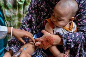 Resurgent Measles Crisis: Bangladesh Launches Emergency Vaccination Campaign Amid Rising Child Mortality
