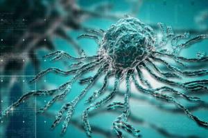 Global Experts Set New Priorities for Cholangiocarcinoma Management in 2026